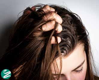 علت چرب شدن موی سر چیست؟